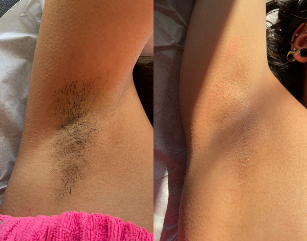 Underarm Wax