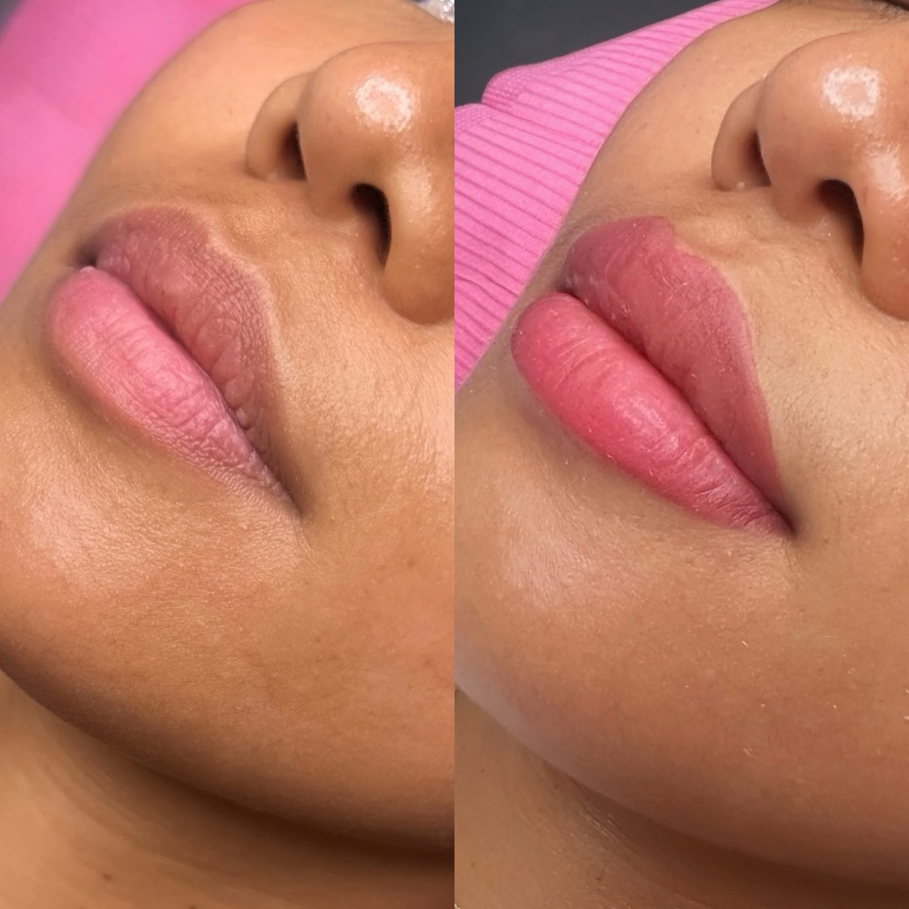 Lip Blushing