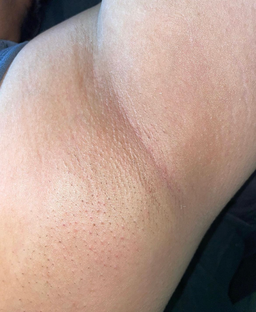 Underarm Wax