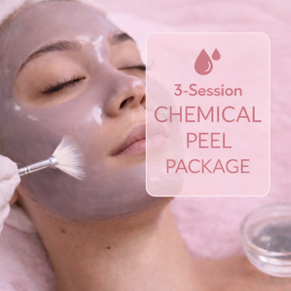 3 Session Chemical Peel Package at Karma Beauty Spa in Plymouth, MI