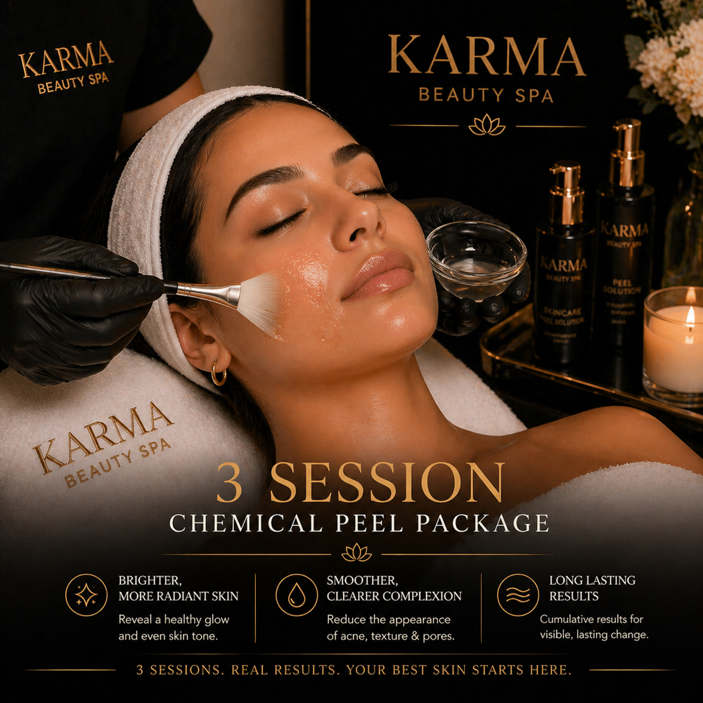 3 Session Chemical Peel Package at Karma Beauty Spa in Livonia, MI