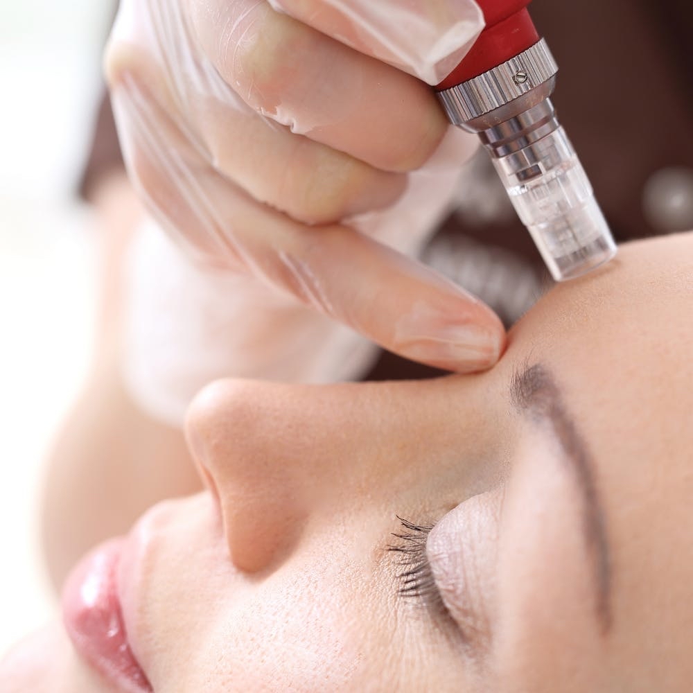 Deluxe Botox Facial