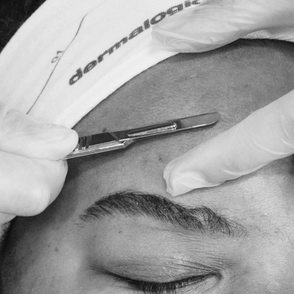 DewyGirl Dermaplaning Facial
