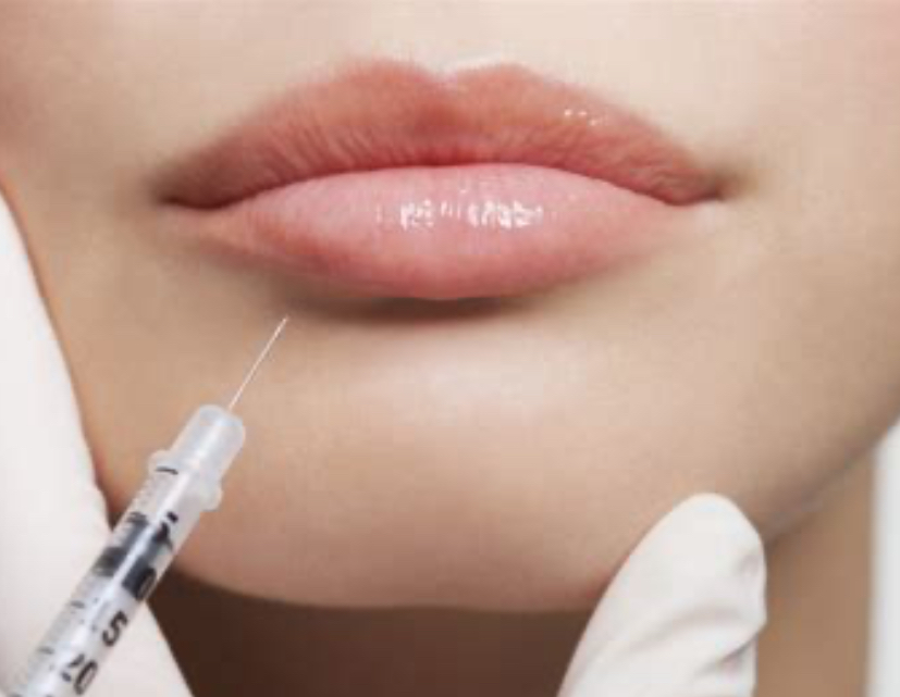 Lip Enhancement💋1 Full Syringe