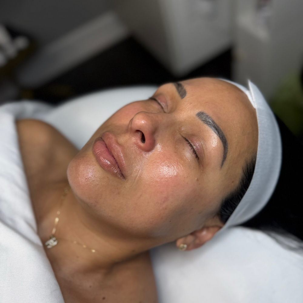 Dermaplane Facial at Essenza Esthetics in Louisville, KY