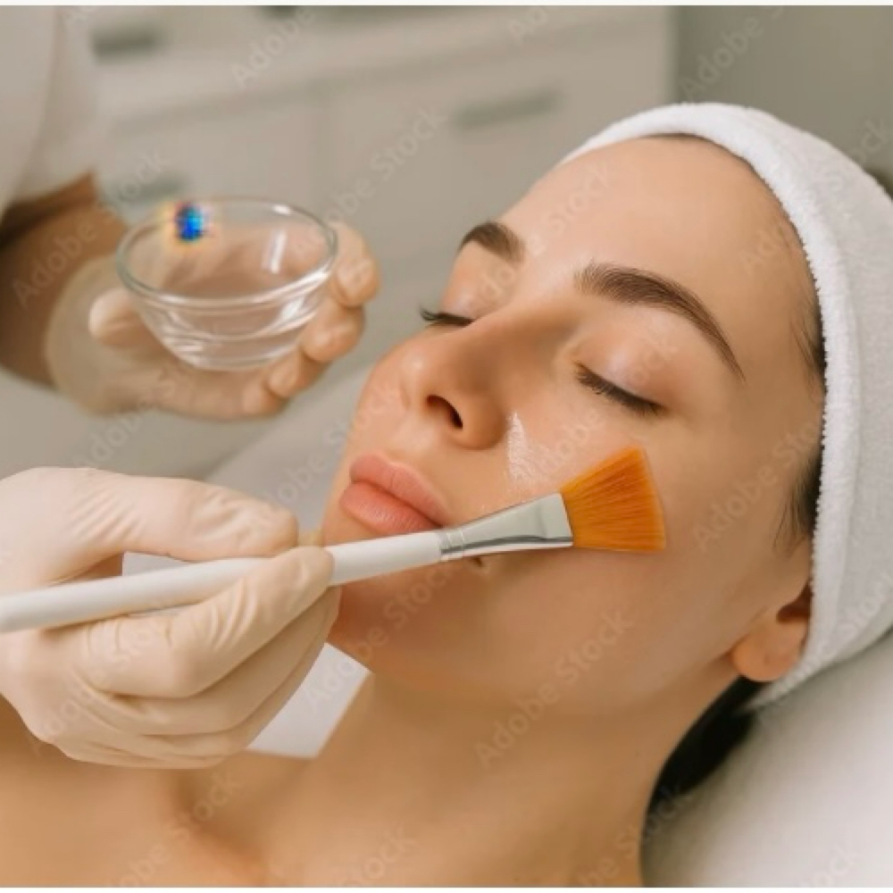 Custom Light Chemical Peel at Southern Glow Skincare in Augusta, GA