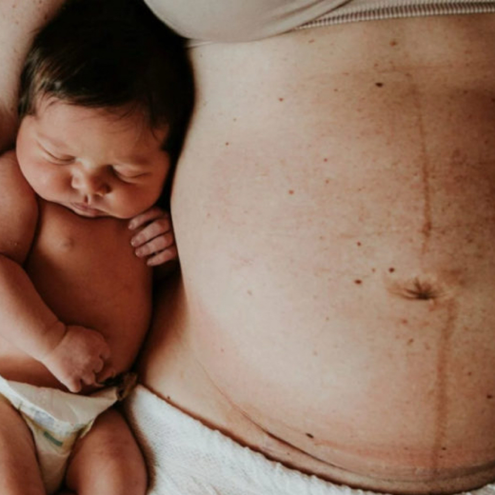 Post-Labor Visit at It is Wellness Holistic Health in Stratford, CT