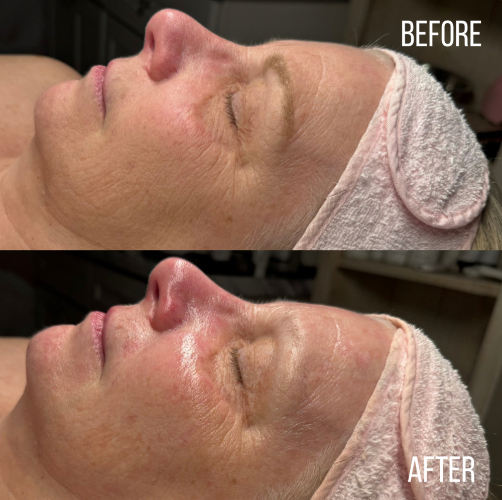 Age Defying Lifting Facial