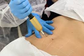 Fat Dissolving Injections Course