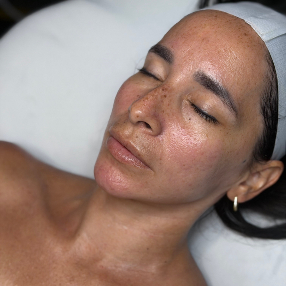 Signature Facial at Essenza Esthetics in Louisville, KY