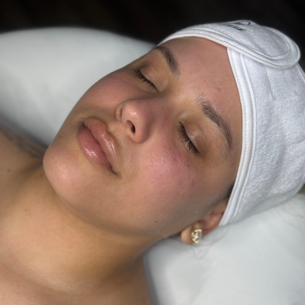Signature Facial at Essenza Esthetics in Louisville, KY