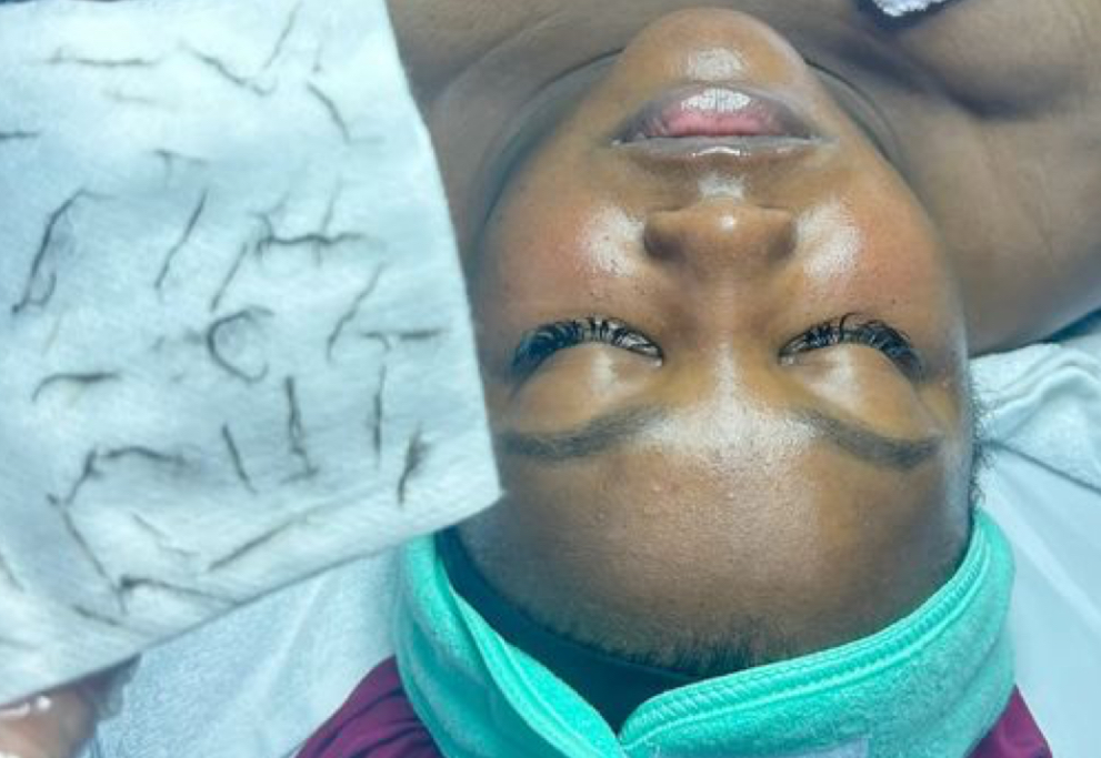 Dermaplane Facial at Jontahontas’ Collection LLC. in Greenville, SC