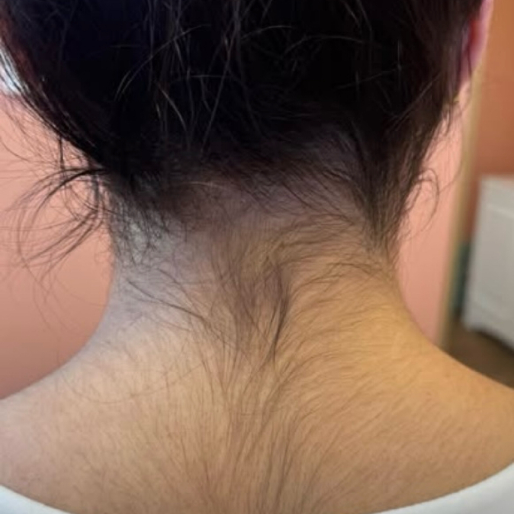 Neck Wax at The Bare Babe Studio OC in Fountain Valley, CA