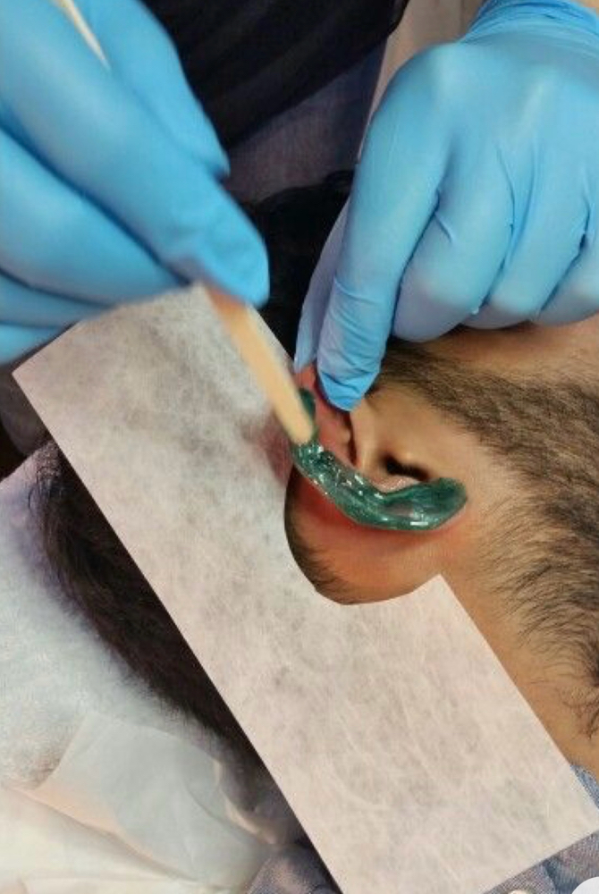 Ear Wax