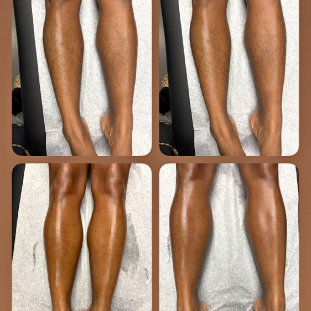 Half Leg at Lavishskn in Charlotte, NC