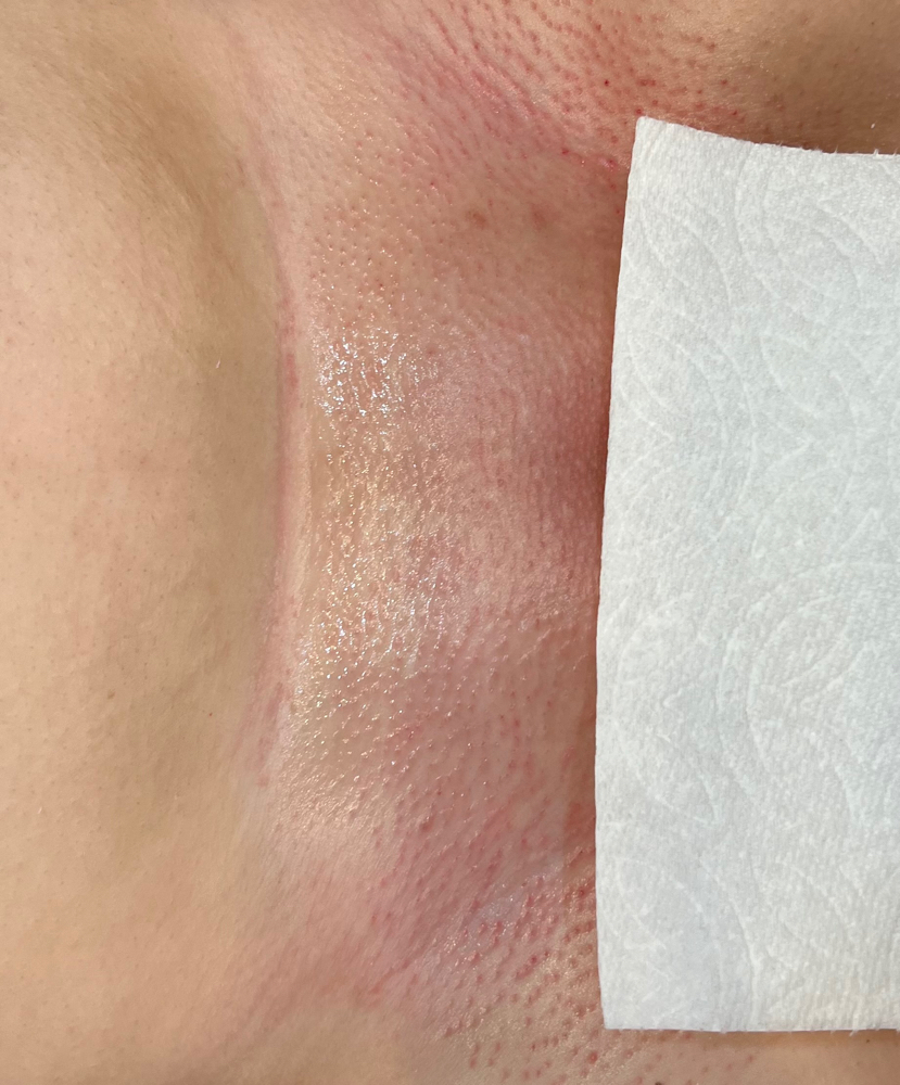 Brazilian Wax