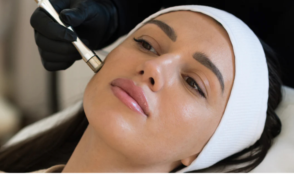 Diamond Tip Microdermabrasion