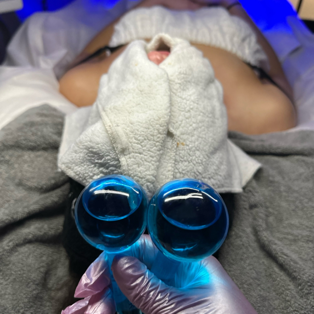 The Total Reset (Best Seller) at Glow A Skin Society in Westlake, OH