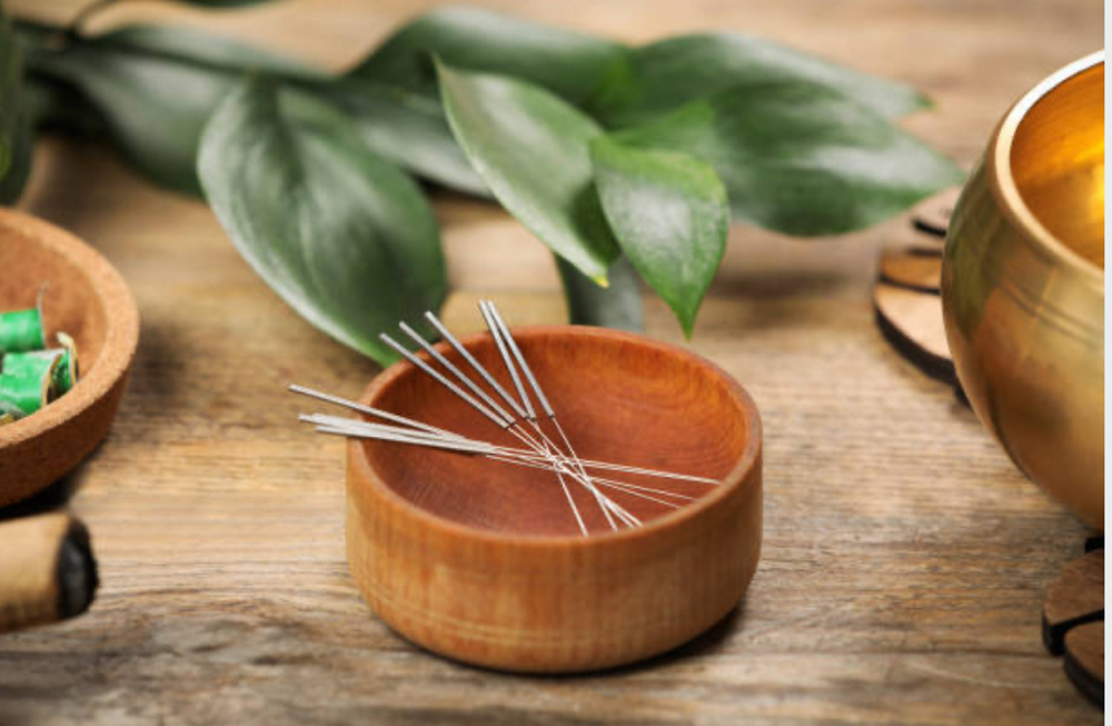 Acupuncture at Melissa purington in Sandy, OR