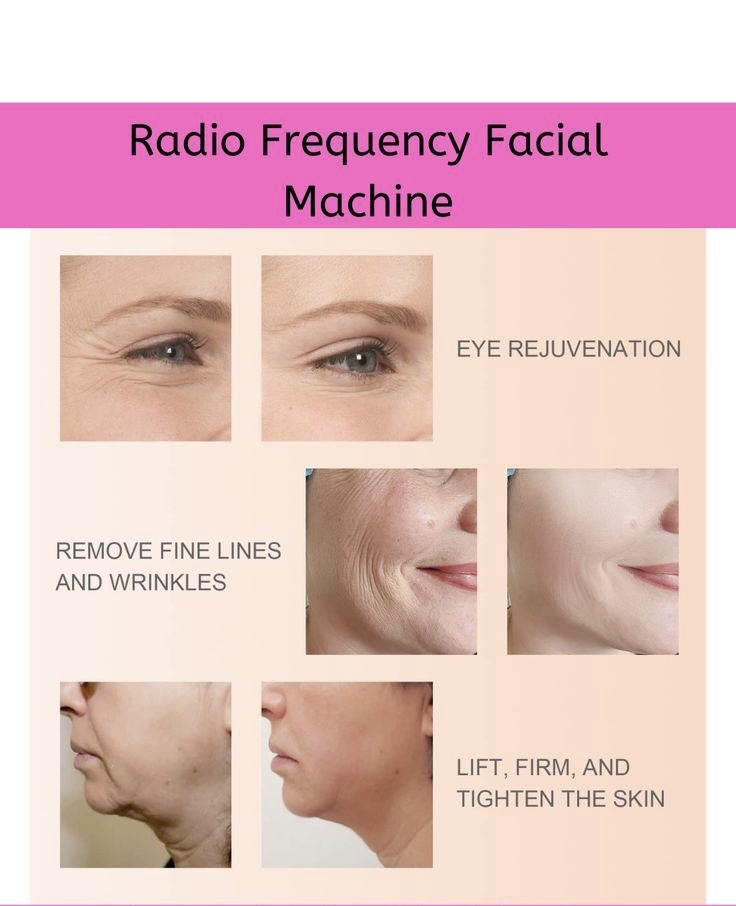 RadioFrequency w/Dermaplane