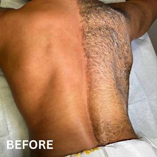 Men’s Back Wax