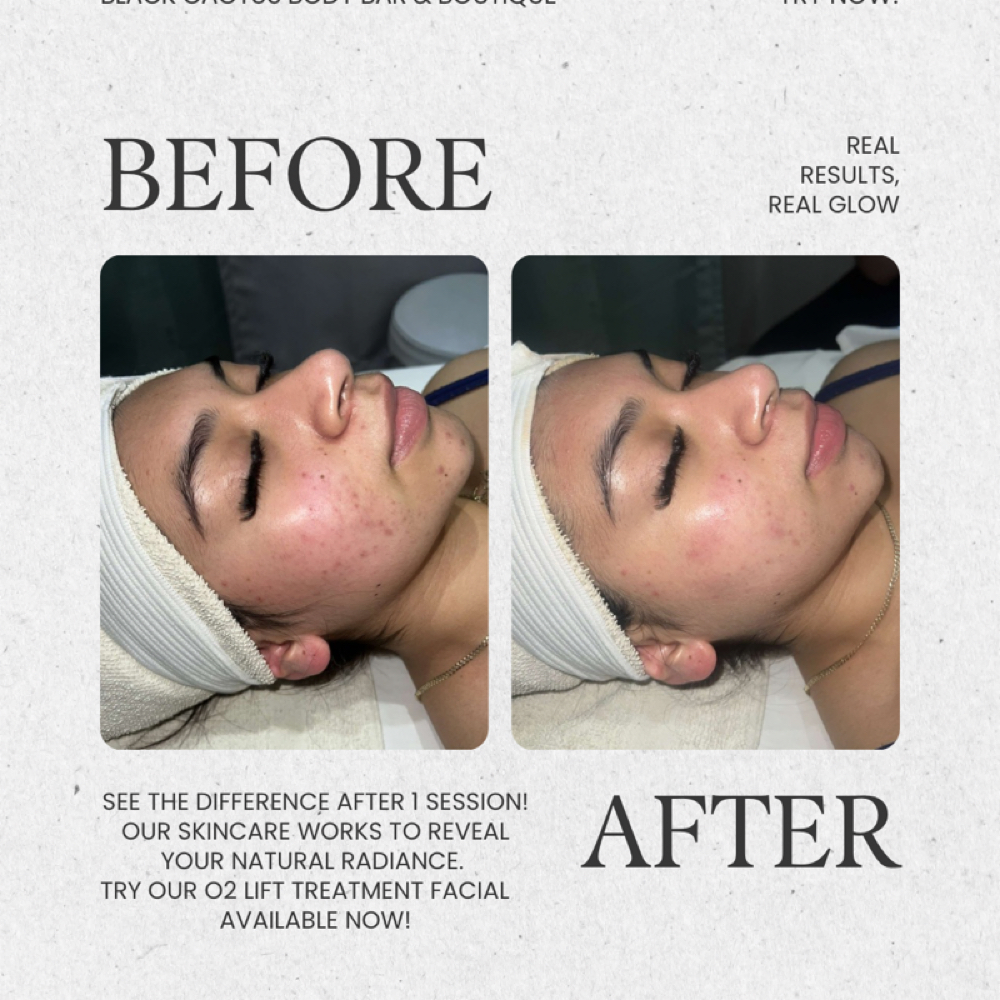 O2 Lift Treatment Facial at Black Cactus Body Bar & Boutique in Mount Juliet, TN
