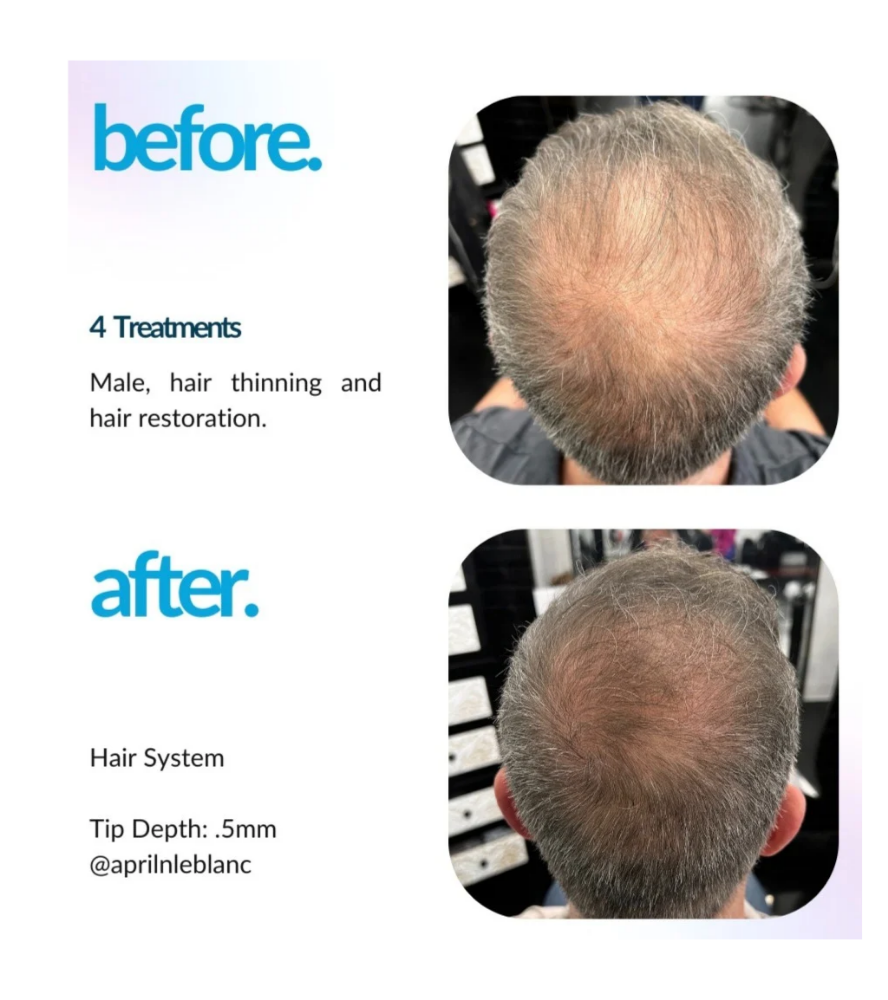 Envy Hair Regrow BOGO 5/1