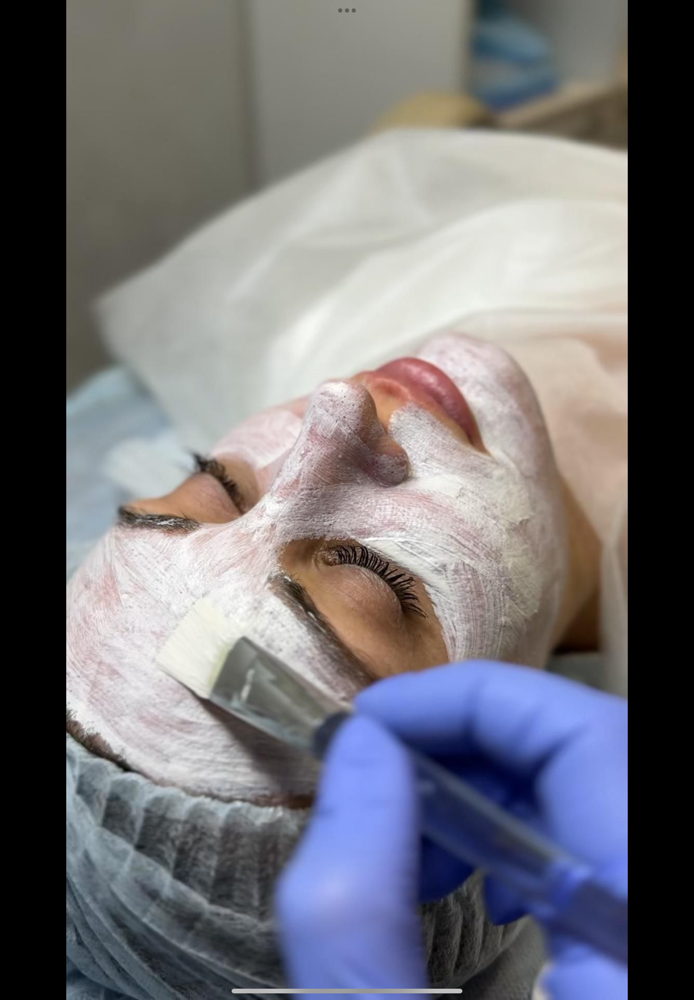 SWiTCH No-downtime Peel at Madi Coca Aesthetics At The Skin Refinery in Nicholasville, KY