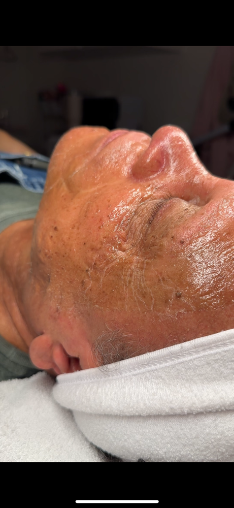 Anti Aging Facial