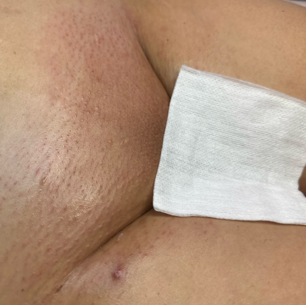 Waxing - Brazilian (Women Only) at Be You Beauty - Esthetics LLC in Tucson, AZ