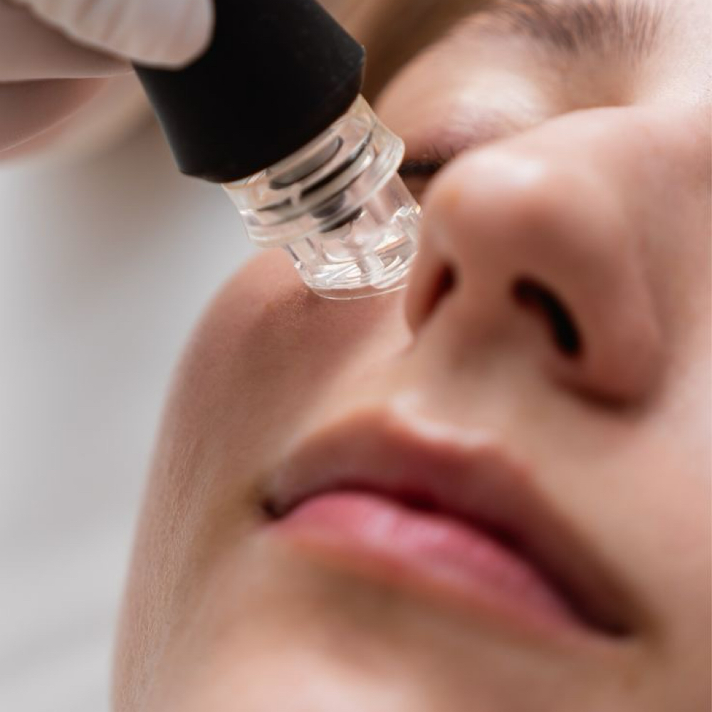 Hydrafacial at RM SKINBAR AND SALON in Little Rock, AR