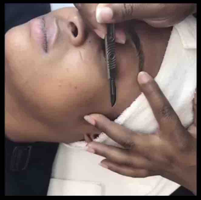 Dermaplaning