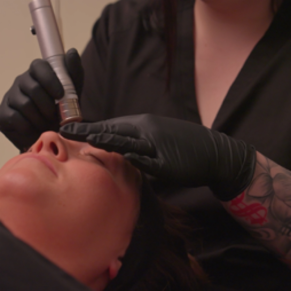 Microdermabrasion at Charismatic Beauty in Apple Valley, CA