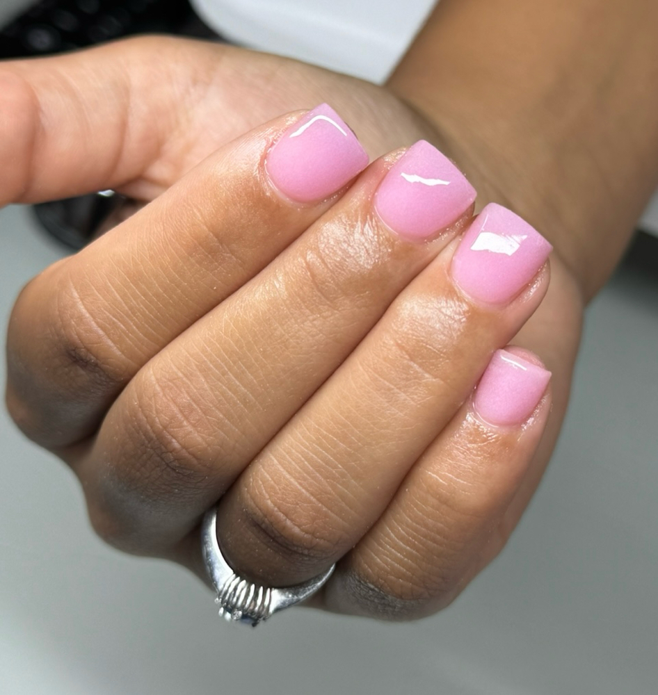 ACRYLIC OVERLAY