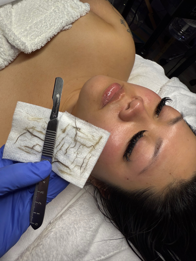 Dermaplane at Moonlight Aesthetics in pensacola, FL