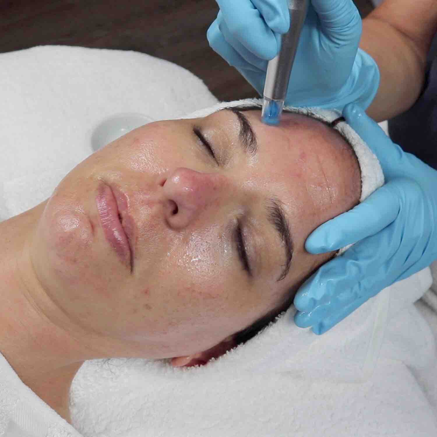 Fountain Of Youth Facial