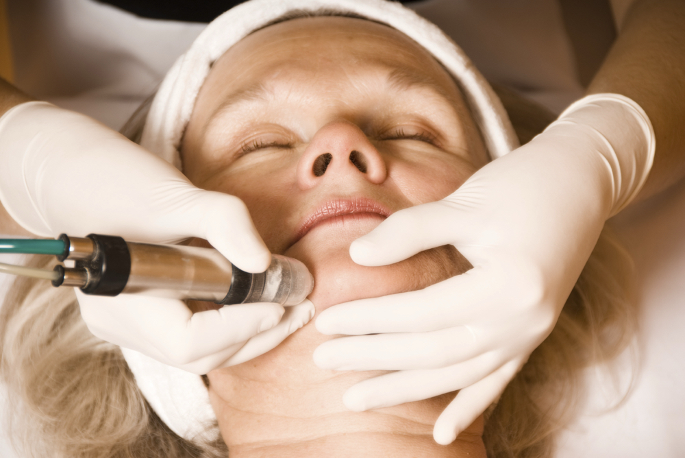 Microdermabrasion Treatment