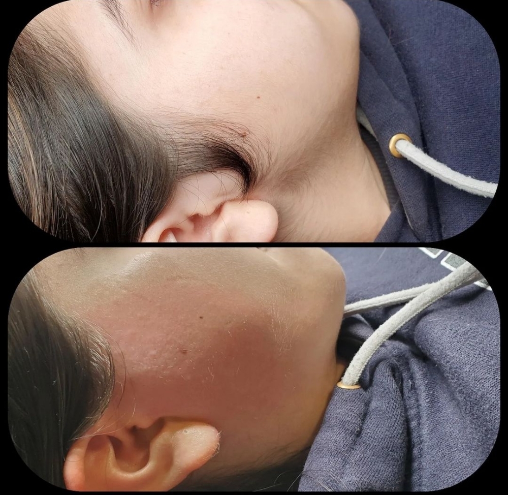 Sideburn Waxing