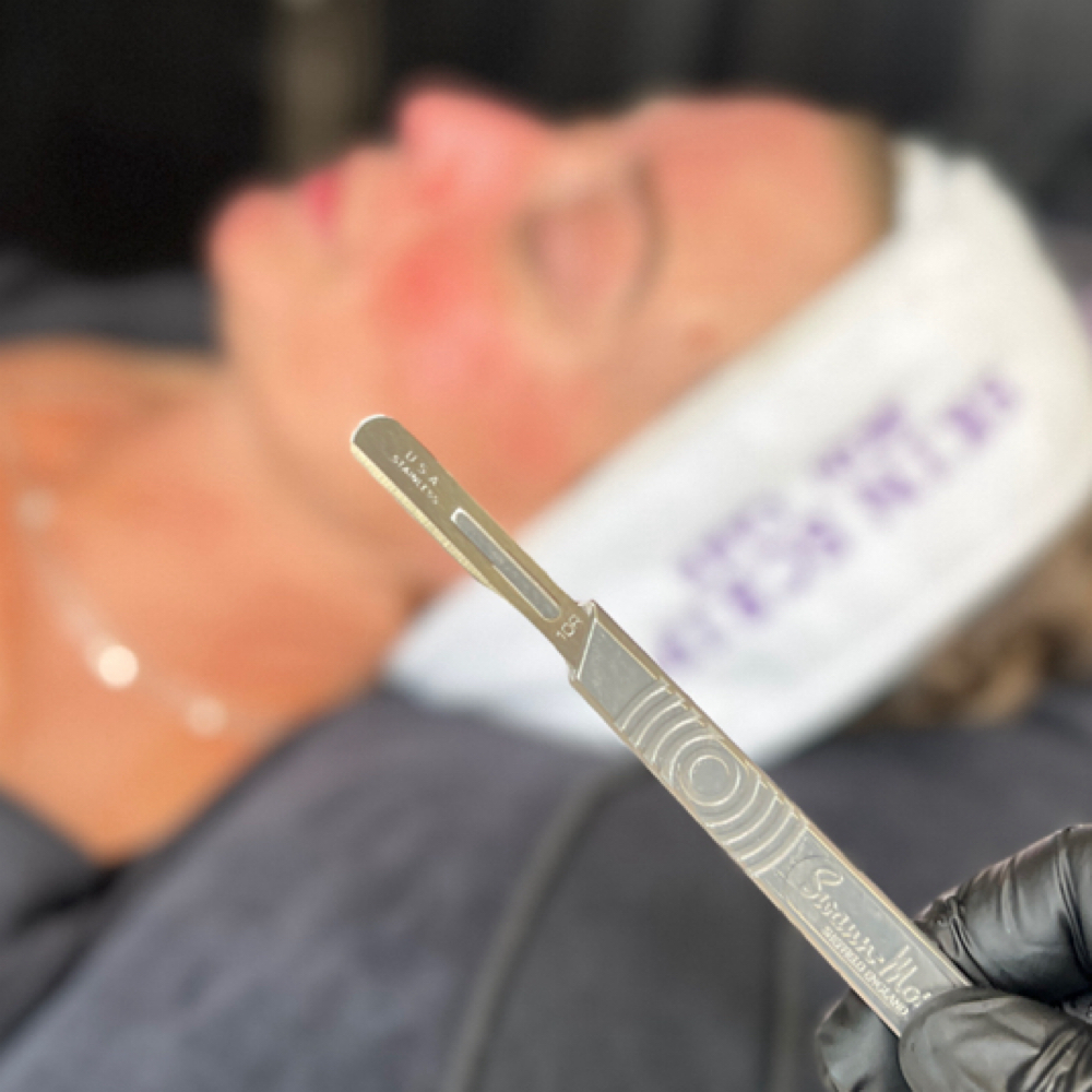 Dermaplane Facial 45 Minutes at Platinum Beauty Esthetics in Rocklin, CA