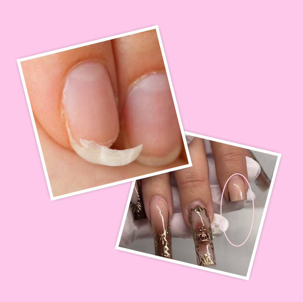 Nail Repair