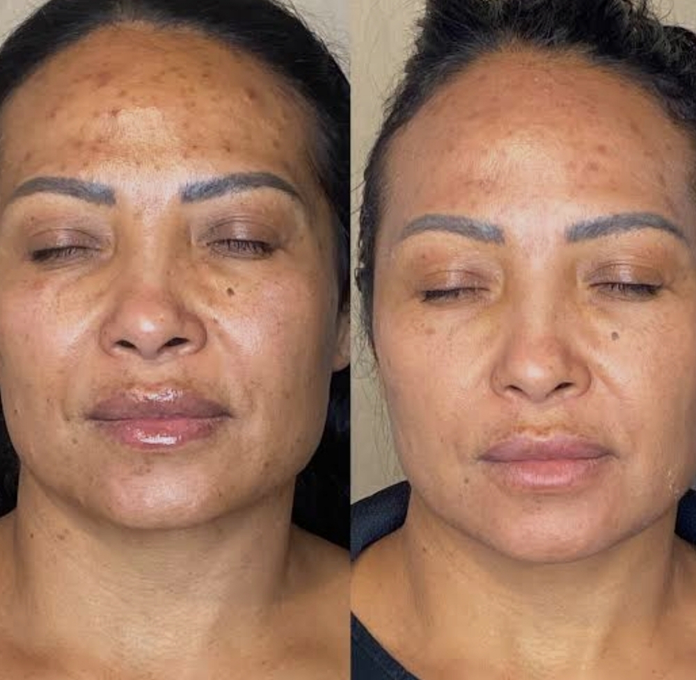 Clarifying Detox Facial