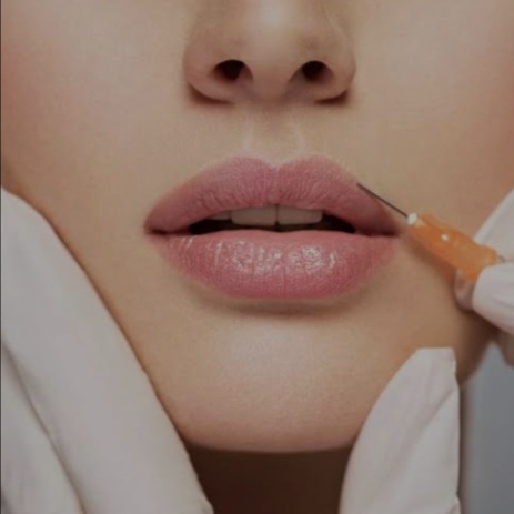 1/2 SYRINGE LIP FILLER at Remake Beauty Studio San Juan in San Juan, TX
