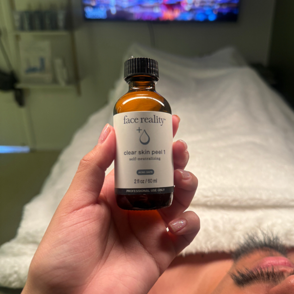 Chemical Peels 🧖🏽♀️ at The Spot Beauty in Phoenix, AZ