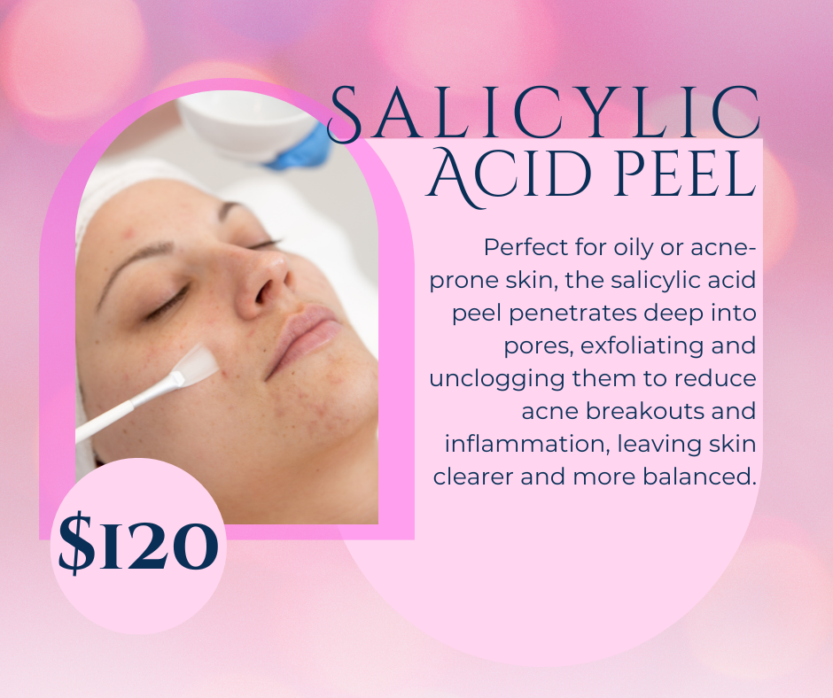 Salicylic Acid Peel