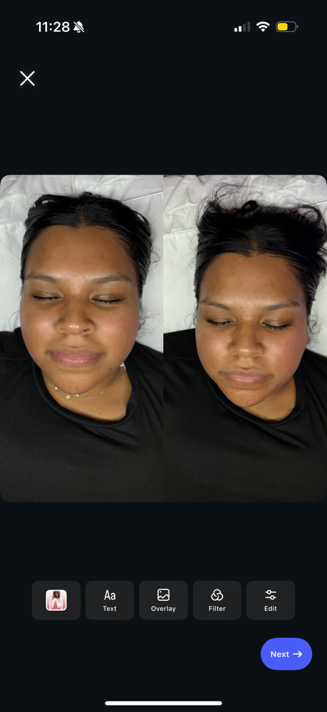 Lift & Sculpt RF Facial at Glowup Beauty LA LLC in Highland Park, CA