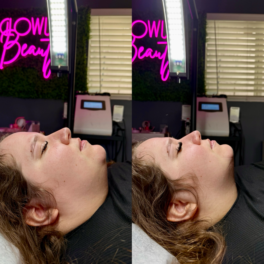 goodbye double chin