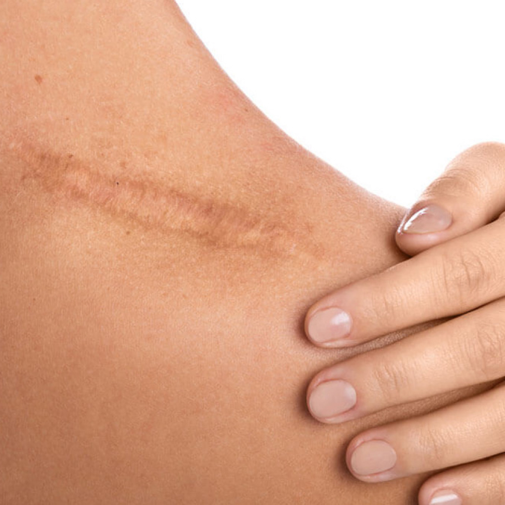 Healing Touch Treatment at Skin Health & Recovery Aesthetics in Greenville, TX