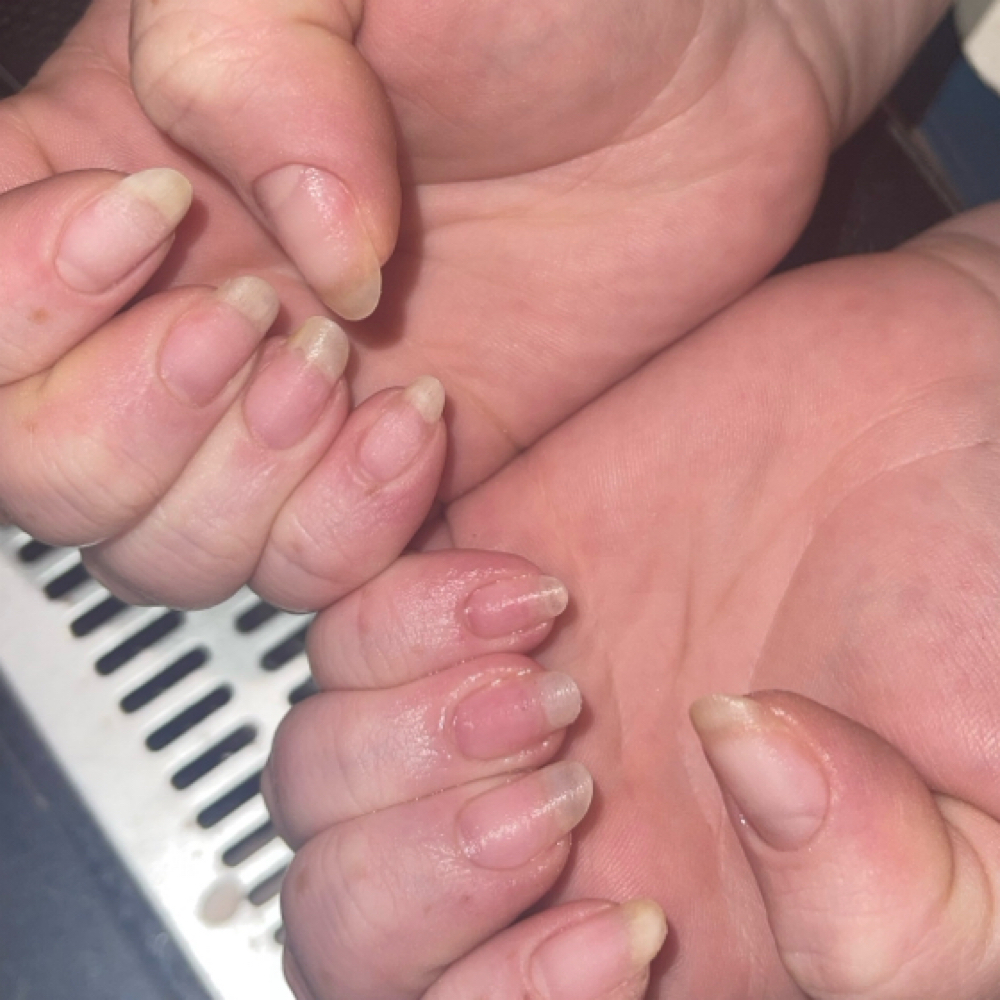 Soak Offs/Removal at Catt Did Thatt Nails in Kingsport, TN
