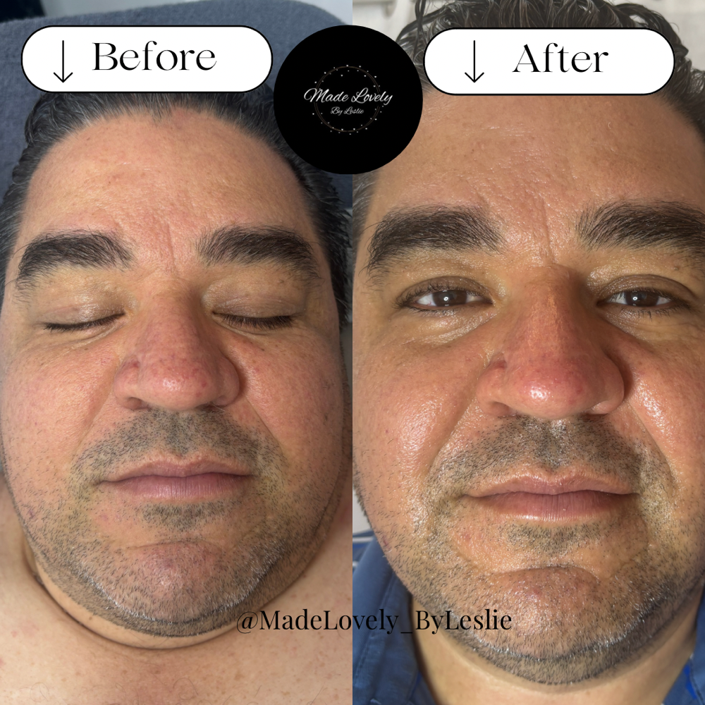 Custom Men's Facial