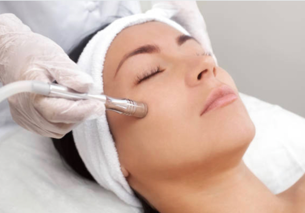 Microdermabrasion Facial